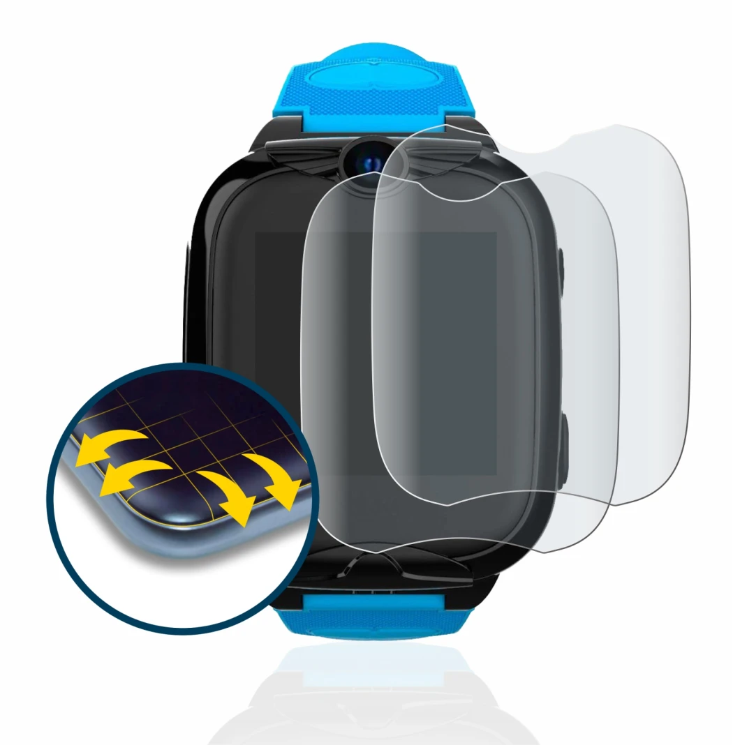 Image de l'appareil Xplora XGO2 avec une grande variété de protections d'écran.