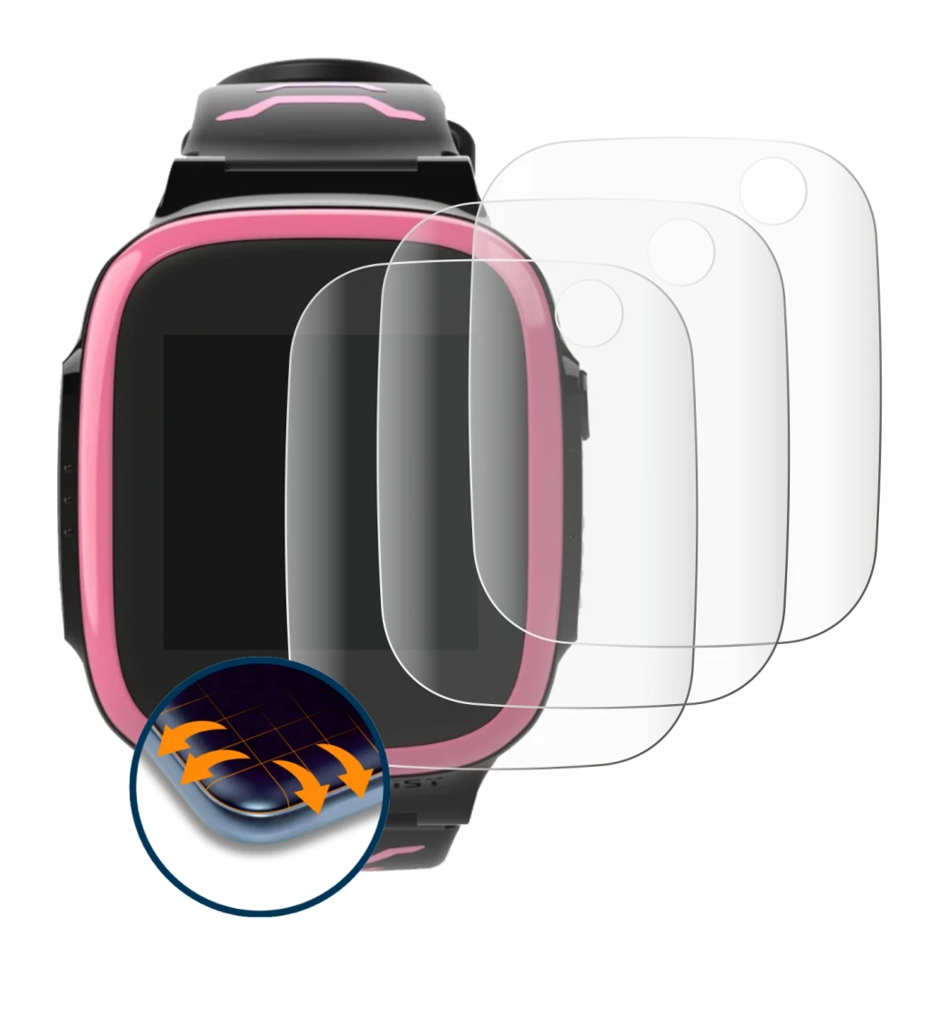 Image de l'appareil Xplora X5 Play avec une grande variété de protections d'écran.