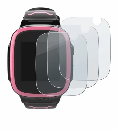 Image de l'appareil Xplora X5 Play avec une grande variété de protections d'écran.