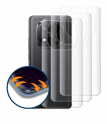 Image de l'appareil Xiaomi Redmi Note 14 Pro Plus (Arrière) avec une grande variété de protections d'écran.