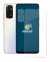 Image de l'appareil Xiaomi Redmi Note 11S (Avant+Caméra) avec une grande variété de protections d'écran.